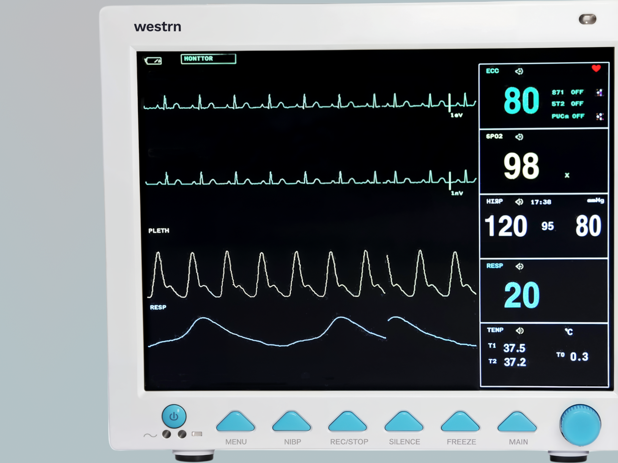 Comprehensive multi-parameter monitoring for adults, pediatrics, and neonates.