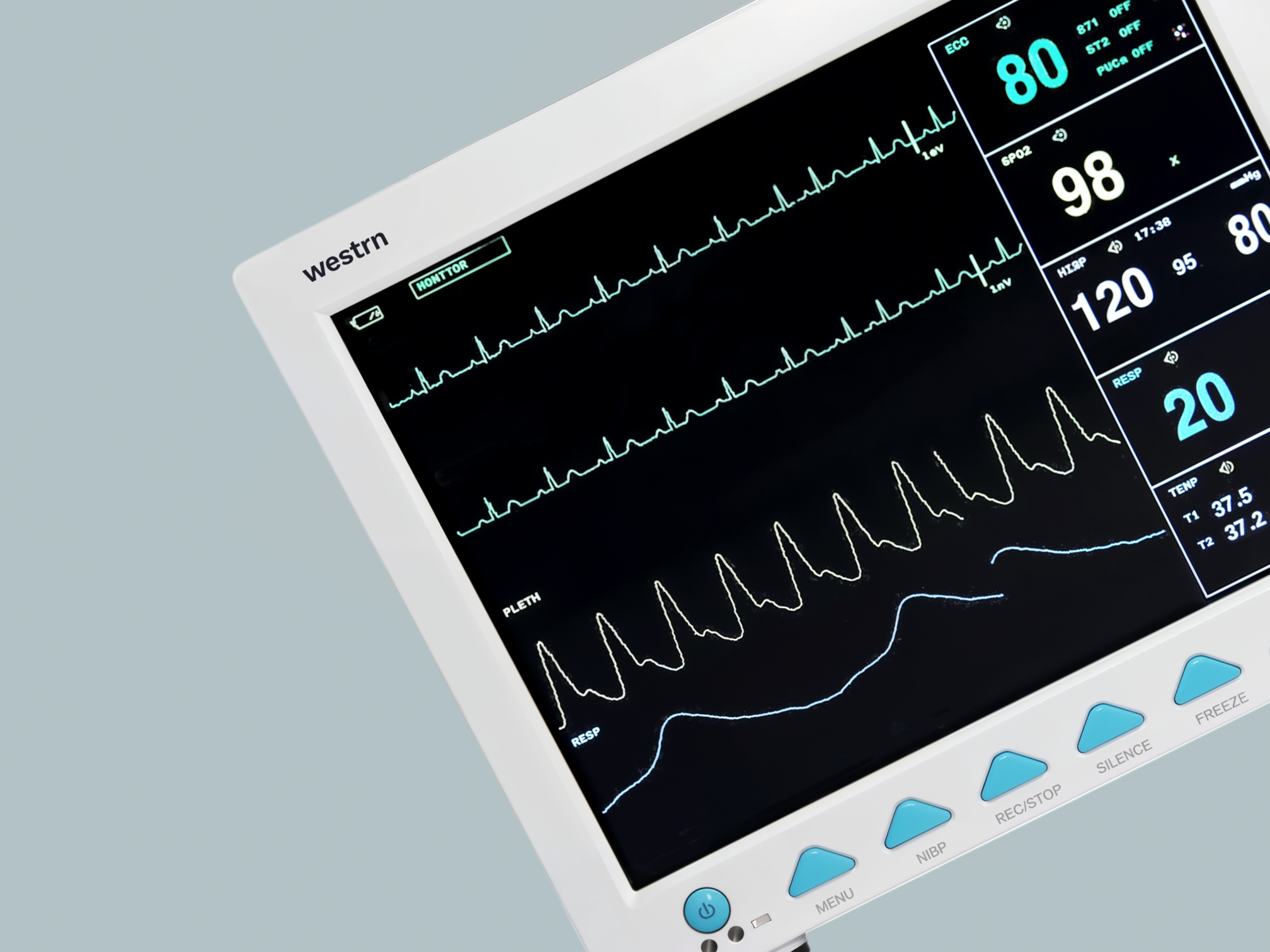 12.1" color TFT screen displays eight real-time waveforms and vital signs simultaneously.